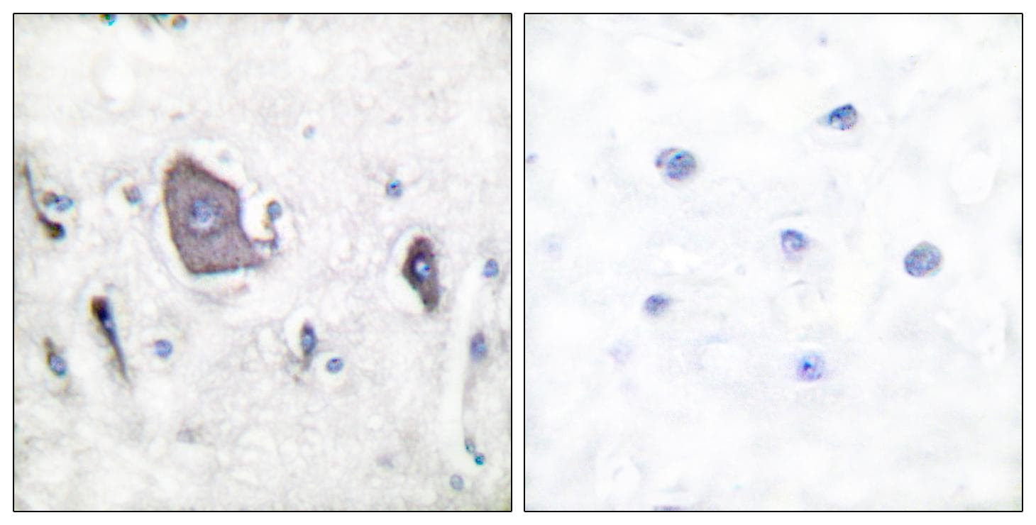 NTRK2 / TRKB Antibody (phospho-Tyr705)