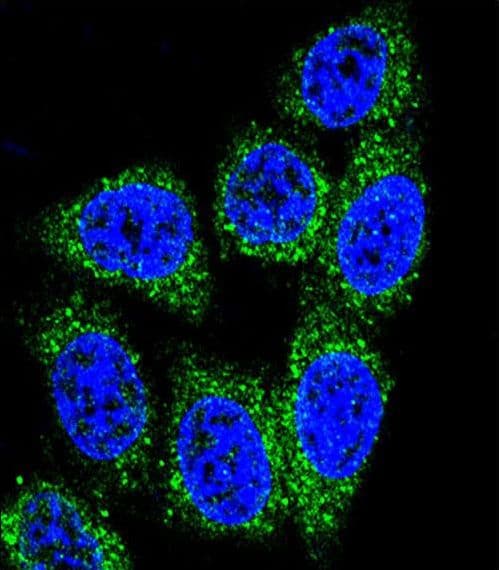 MUTYH / MYH Antibody (aa341-367)