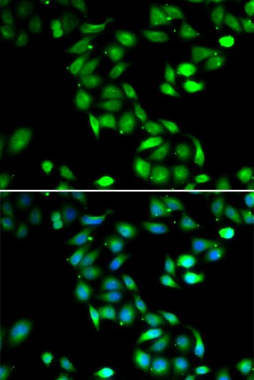 IHC-plus™ PDCD6 / ALG-2 Antibody