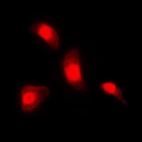 NFATC4 / NFAT3 Antibody (C-Terminus)