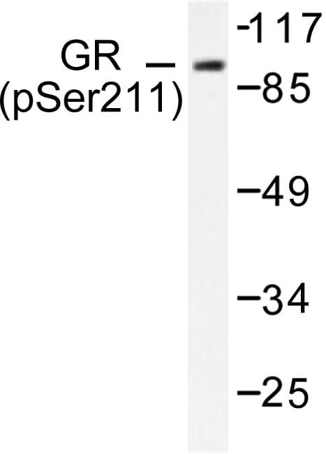 NR3C1/Glucocorticoid Receptor Antibody (phospho-Ser211)