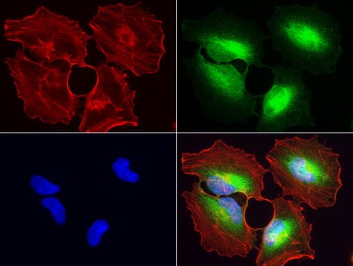 WIBG Antibody (clone UMAB208)