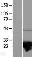 RAB37 Protein (Over-Expression Lysate Myc-DDK (Flag))