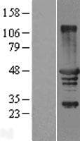 TCP10 Protein (Over-Expression Lysate Myc-DDK (Flag))