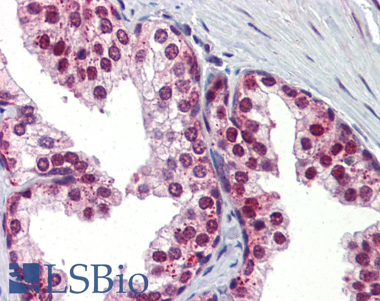 UBQLN1 / Ubiquilin Antibody (aa290-339)