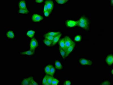 RBM45 / DRB1 Antibody