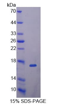 Human DKK4 Protein (Recombinant His-T7)