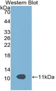 APOC3 / Apolipoprotein C III Antibody (aa21-101)