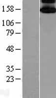Human MAP3K5 / ASK1 Protein (Over-Expression Lysate Myc-DDK (Flag))