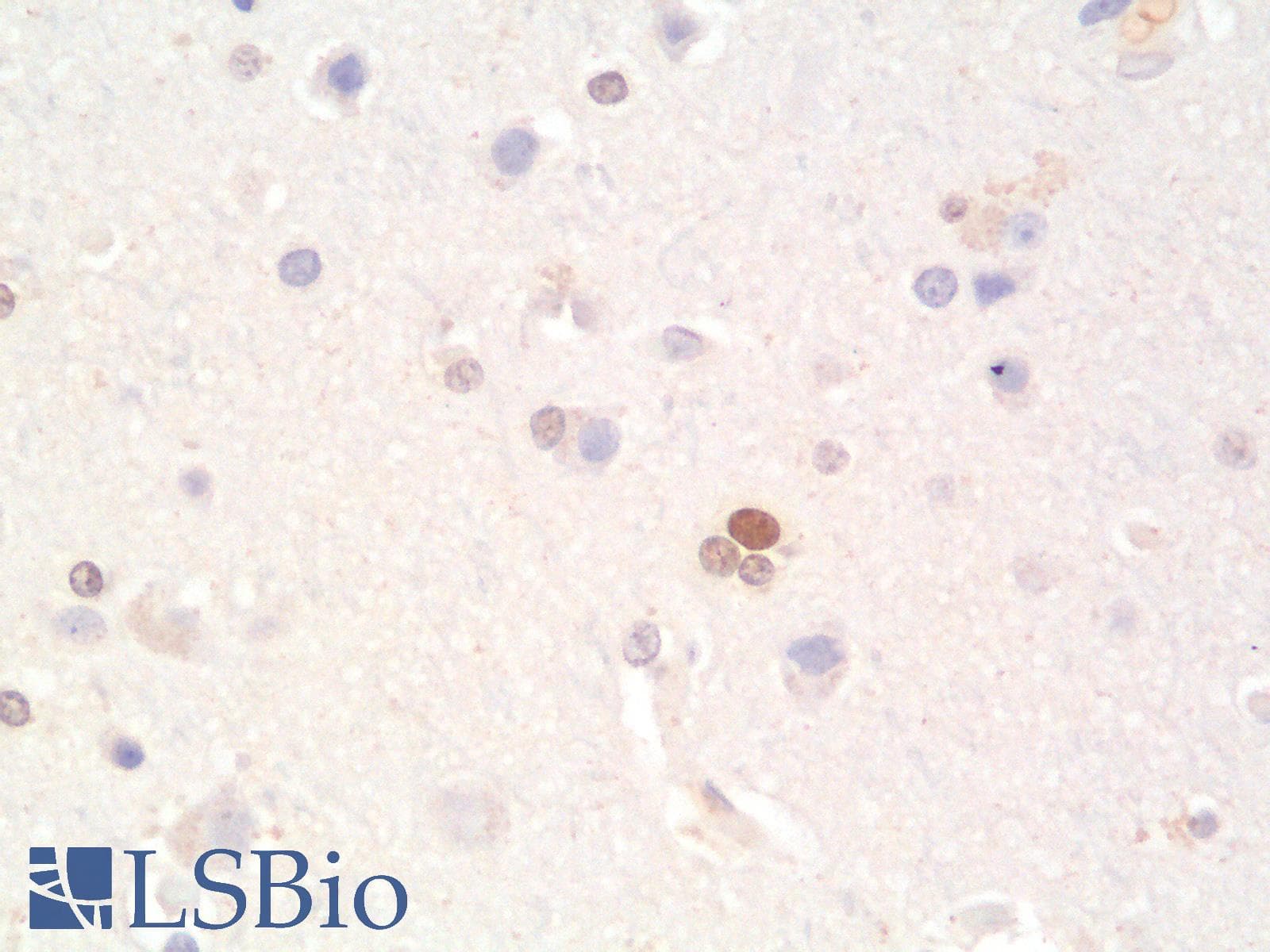 PathPlus™ NKX2-2 Antibody (clone rNX2/294)