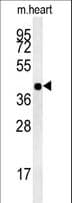 Polyclonal Rabbit anti-Human ISPD / Nip Antibody (aa400-429, WB)