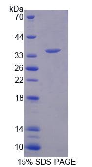 Human ARSF / Arylsulfatase F Protein (Recombinant His-T7)