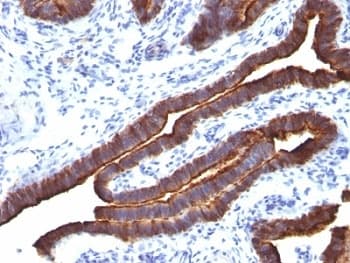 EMA / MUC1 Antibody (clone MUC1/955)