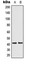 Polyclonal Rabbit anti-Human KCNK15 Antibody (C-Terminus, IHC, WB)