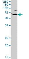 EZR / Ezrin Antibody (clone 1E11)