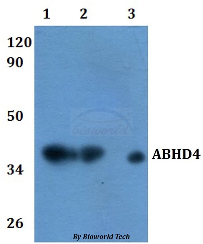 Polyclonal Rabbit anti-Human ABHD4 Antibody (IHC, WB)