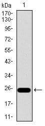 ITGB4 / Integrin Beta 4 Antibody (Amino Acid: 1619-1822, clone 10B10D5)