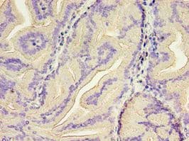 GSN / Gelsolin Antibody (aa28-782)
