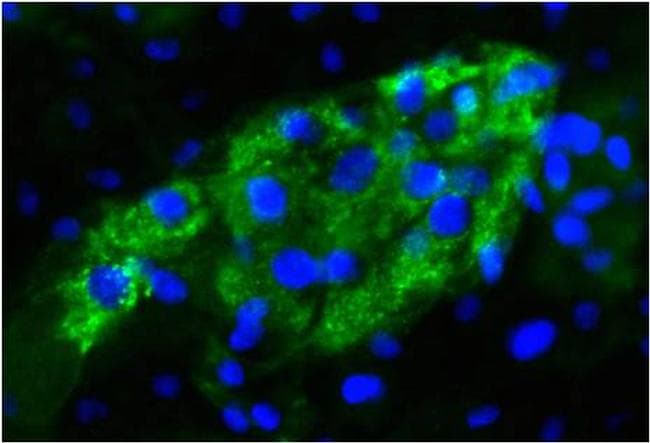 Alpha-Fetoprotein Antibody (clone P5B8)
