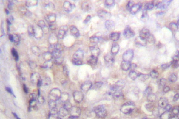 Polyclonal Rabbit anti-Human RAF1 / RAF Antibody (Ser291, IHC, WB)