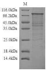 Rat TLR4 Protein (Recombinant 10His-SUMO, N-terminus + Myc, C-terminus)