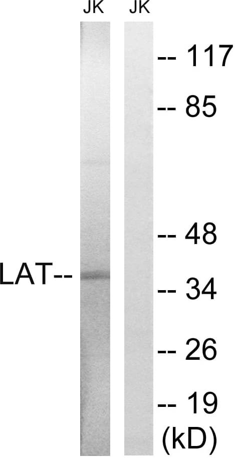 Polyclonal Rabbit anti-Human LAT Antibody (aa86-135, WB)