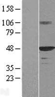 DNAJA1 / HDJ2 Protein (Over-Expression Lysate Myc-DDK (Flag))