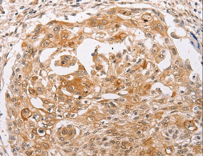 PPP1CB Antibody