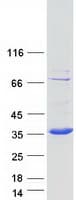 Human ECHDC1 Protein (Recombinant Myc-DDK (Flag))