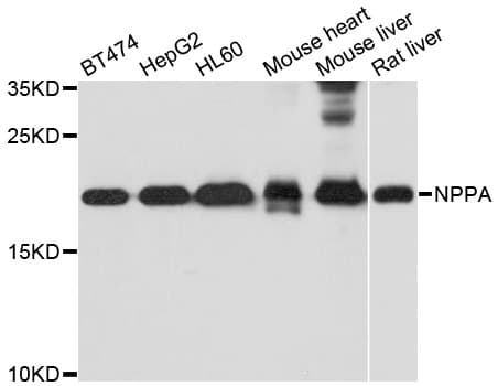 NPPA / ANP Antibody