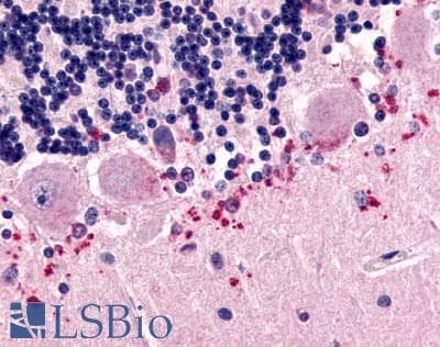 PathPlus™ CELSR3 Antibody (N-Terminus)