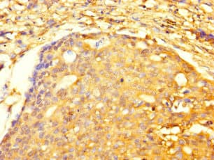 TRIM74 Antibody