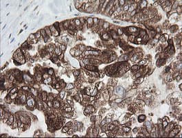 TAPBPL / TAPBPR Antibody (clone OTI4H5)