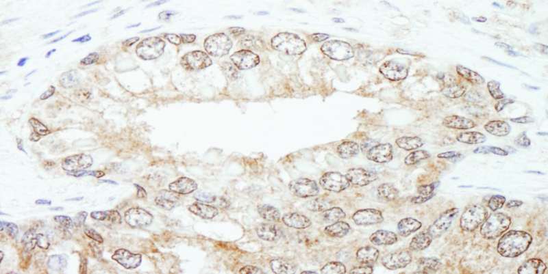 Polyclonal Rabbit anti-Human KPNA3 / Importin Alpha 4 Antibody (aa1-50, IHC, WB)