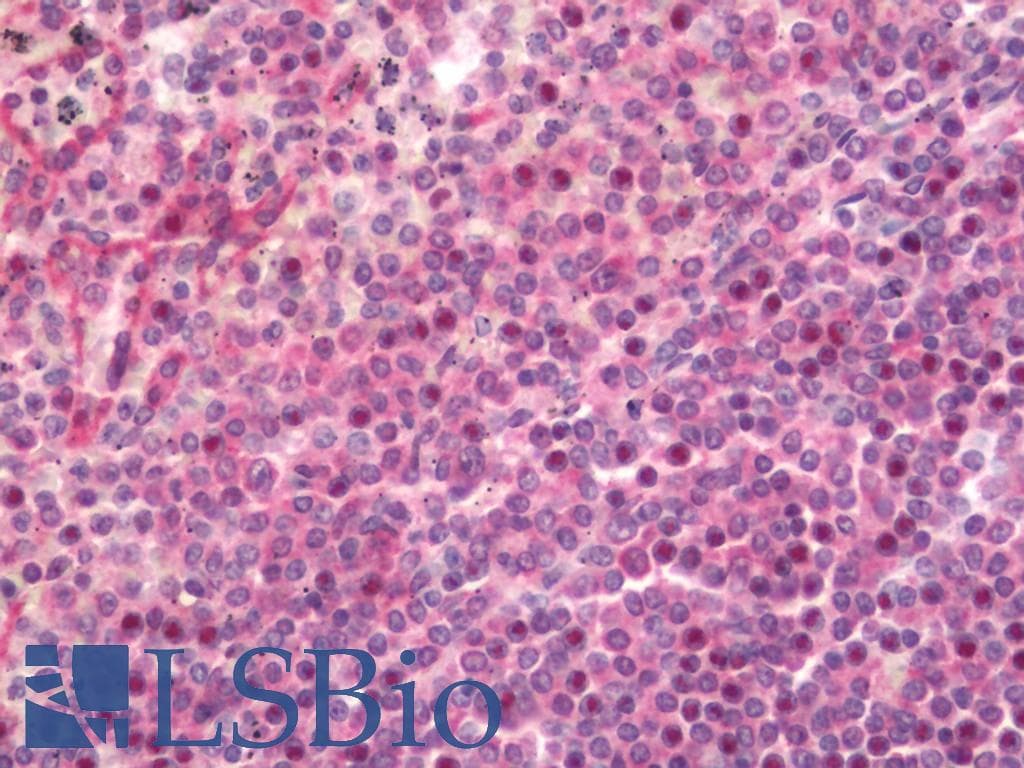 IHC-plus™ PTPN5 / STEP Antibody
