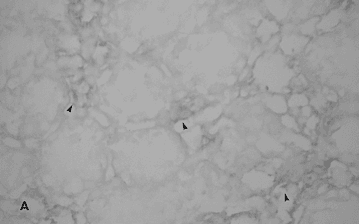 Monoclonal Mouse anti-Human EDN1 / Endothelin 1 Antibody (clone 20-2111.41, IHC, IF)