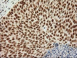 LOX / Lysyl Oxidase Antibody (clone OTI9G2)