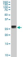 HMG2 / HMGB2 Antibody (clone 3E5)
