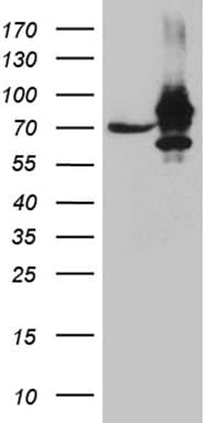 Monoclonal Mouse anti-Human IMP-3 / IGF2BP3 Antibody (clone OTI6A3, IHC, WB)