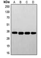 FOLR1 / Folate Receptor Alpha Antibody (Internal)