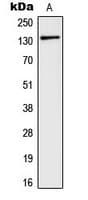 GRM5 / MGLUR5 Antibody (N-Terminus)