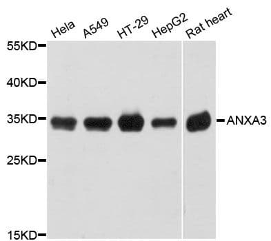 ANXA3 / Annexin A3 Antibody