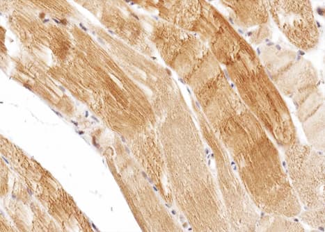 CPT1B Antibody