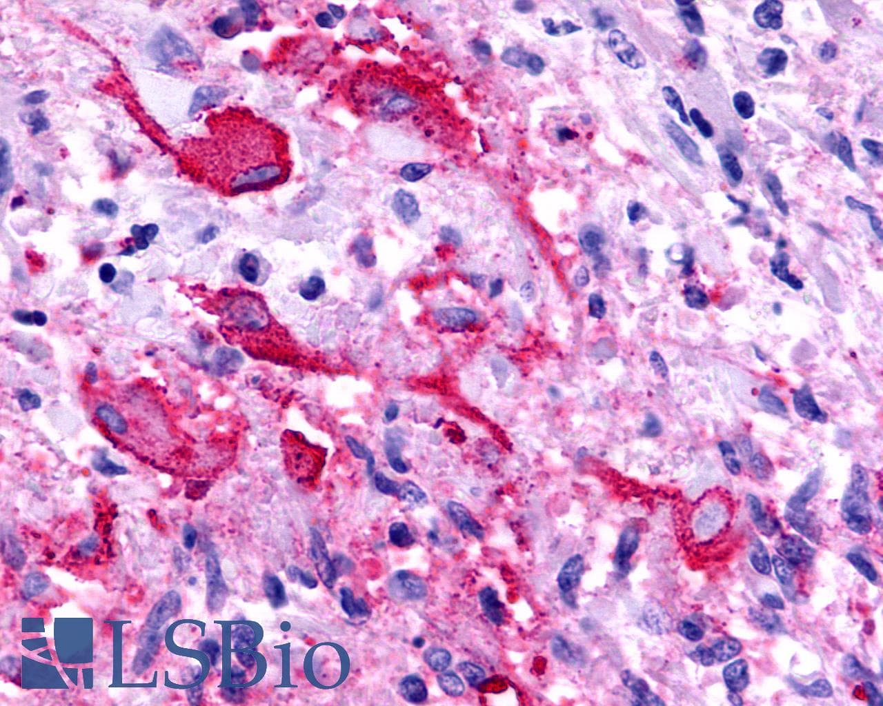 IHC-plus™ Polyclonal Rabbit anti-Human TPRA1 / GPR175 Antibody (Cytoplasmic Domain, IHC)