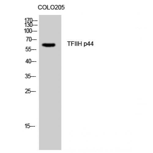 GTF2H2 Antibody (1-80 aa, N-terminal)