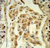 Polyclonal Rabbit anti-Human ESPN / Espin Antibody (aa17-45, IHC, WB)