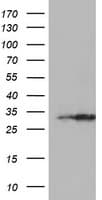 EXOSC7 Antibody (clone OTI2E5)