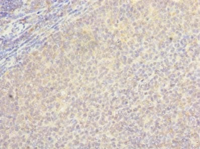 LOH12CR1 Antibody