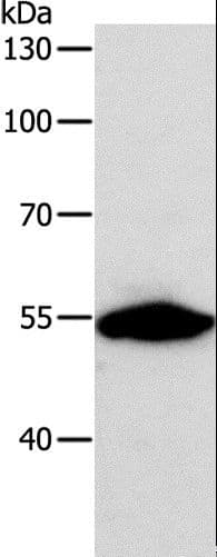 CALR / Calreticulin Antibody