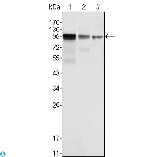FER Antibody